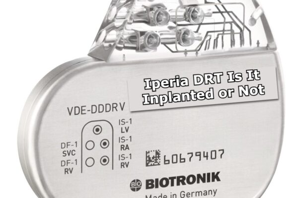 Iperia DRT Is It Inplanted or Not